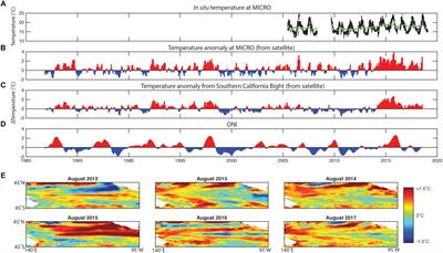 Role of ENSO Conditions on Particulate Organic Matter Concentrations and Elemental Ratios in the Southern California Bight